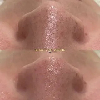 マツエク・マツパ ビューティー ミロワールのエステ・リラクイメージ