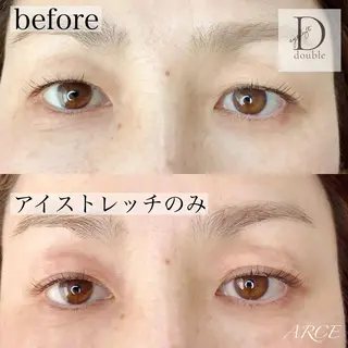 マツエク・マツパ 美容室 ARCE所属・セラピスト MIKIのエステ・リラクイメージ