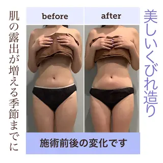 エステサロン JURISのエステ・リラクイメージ