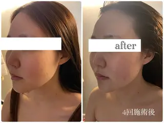 Anjir（アンジール）所属・完全個室サロン Anjirのエステ・リラクイメージ