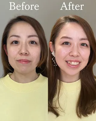 植木 萌恵のヘアスタイル