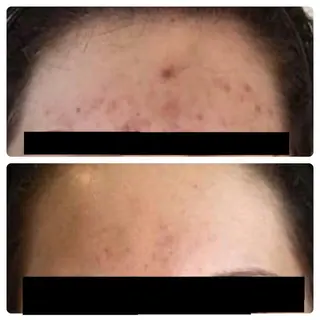 自爪育成ネイルサロン ココリュバンのネイルデザイン