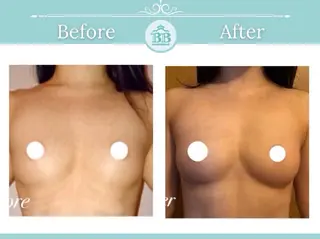 美人バスト本厚木店所属・美人バスト 本厚木店のエステ・リラクイメージ