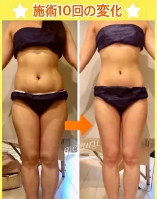 ショート カラー パーマ ヘアアレンジ メンズ キッズ ネイル マツエク・マツパ ‍痩身＆ボディ 結果出し🌟丹野のエステ・リラクイメージ