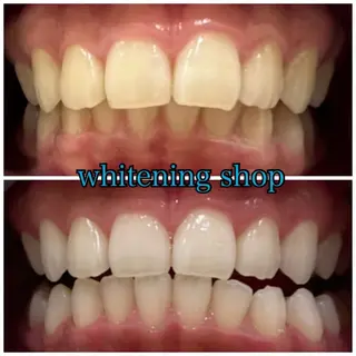 ホワイトニングショップせんげん台店所属・スタッフ 兎洞のその他イメージ