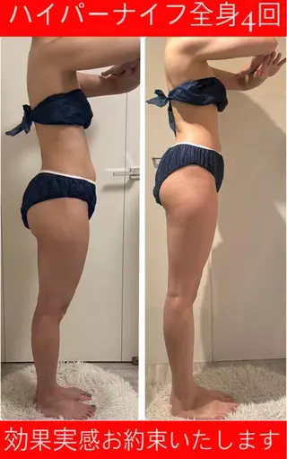 M.plus  エムプリュ所属・よもぎ蒸し、セル撃退 専門店M.plusのエステ・リラクイメージ