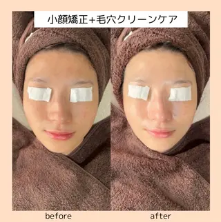 【three】毛穴/ 肌改善/小顔/耳ツボのエステ・リラクイメージ