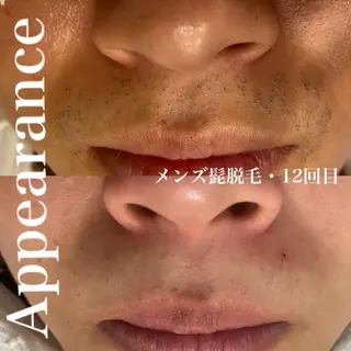 Appearance所属・Appearance 【アピアランス】のエステ・リラクイメージ