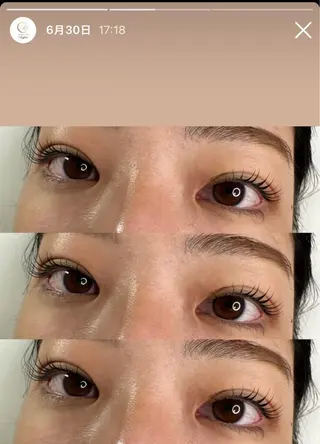 マツエク・マツパ total beauty salon Raffoler所属・Raffoler りさのエステ・リラクイメージ