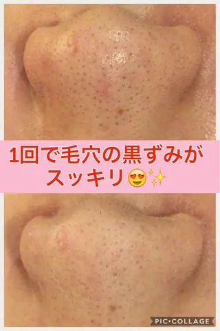 ショート カラー パーマ ヘアアレンジ メンズ キッズ ネイル マツエク・マツパ ニキビ・肌質改善専門 ♡人生が変わるサロンのエステ・リラクイメージ