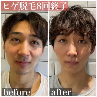 HAIRS YOSHIOKA所属・ヘアーズヨシオカ MENSヒゲ脱毛のエステ・リラクイメージ