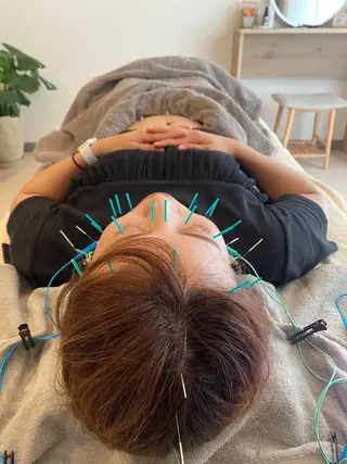 鍼灸•マッサージサロンCalfa所属・《美肌･小顔》美容鍼 ＆マッサージ＊MEIのエステ・リラクイメージ