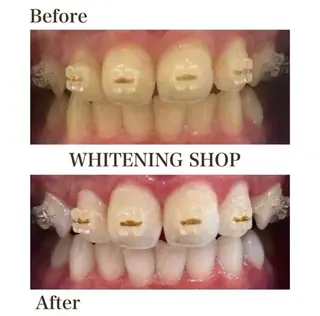 ホワイトニングショップ伊丹店所属・ホワイトニング ショップ伊丹店のその他イメージ