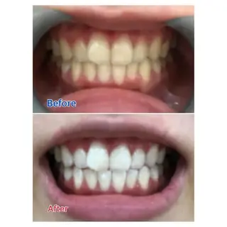 M渋谷店所属・M渋谷 ホワイトニングのエステ・リラクイメージ