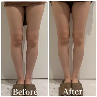 💎小顔ｻﾛﾝ アリリン銀座💎のエステ・リラクイメージ