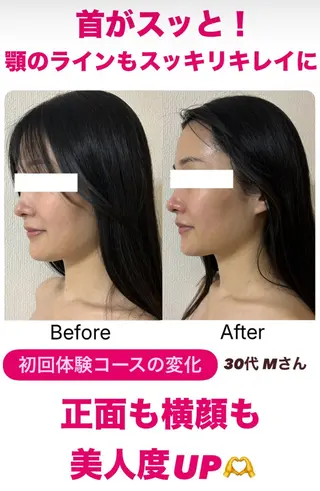 la lumie're (ラ リュミエール)所属・小顔サロン (ラ リュミエール)のエステ・リラクイメージ