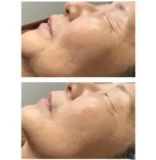 肌質改善◇結果重視 美麗-MIREI-のマツエク・マツパデザイン