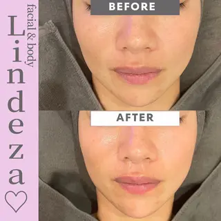 リンデザ 山口のエステ・リラクイメージ