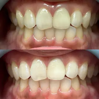 セルフホワイトニング～幸 Sachi〜所属・セルフホワイトニング 〜幸Sachi〜のその他イメージ