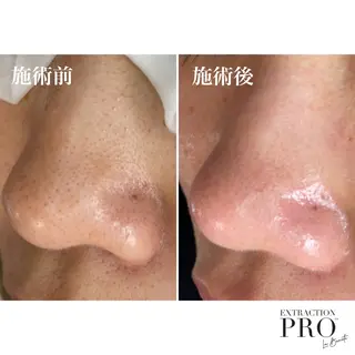 毛穴専門店アイミュー mamiのエステ・リラクイメージ