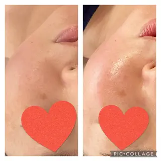 サロンドフルベール 黒崎中央店所属・サロンド フルベール 黒崎中央店のエステ・リラクイメージ