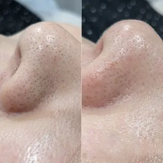 fors 梅田所属・saki 束感まつ毛/ 大阪のマツエク・マツパデザイン