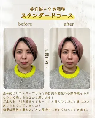 鍼灸 PALMのエステ・リラクイメージ