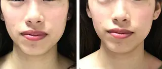 salon.plaisir（プレズィール）所属・酒井 瑠未のエステ・リラクイメージ