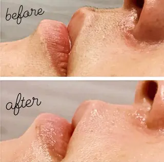 Nail & 高速脱毛 avenir【アヴニール】所属・WAX/眉/光脱毛 🌿リラク/小顔のエステ・リラクイメージ