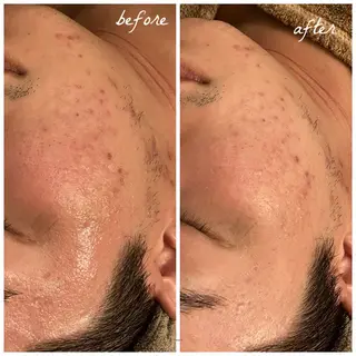 メンズ メナード岐阜市茜部 杉浦のエステ・リラクイメージ