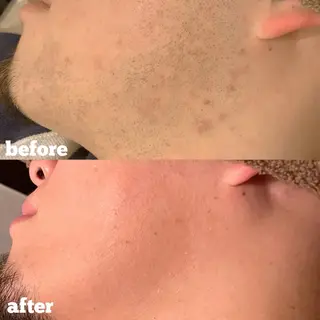 脱毛サロン ECXIA【博多】のエステ・リラクイメージ