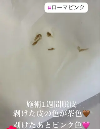 EstheticSalonReTweet所属・竹谷 春希のエステ・リラクイメージ