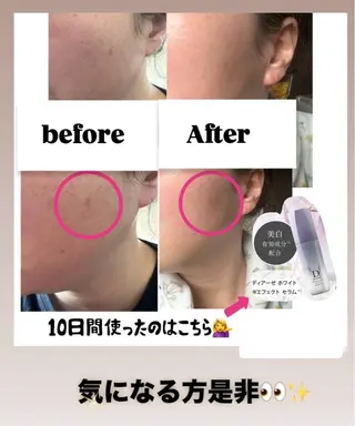 ROR Akariのエステ・リラクイメージ