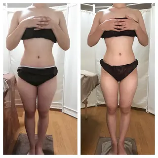 biloop所属・《痩身×疲労改善》 BILOOPのエステ・リラクイメージ