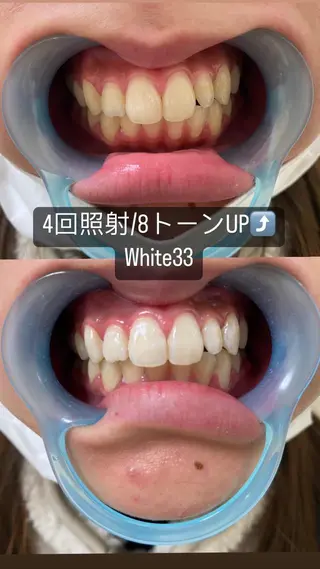 アイブロウ セルフホワイトニング White33大名のその他イメージ