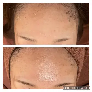 ロング カラー パーマ ヘアアレンジ メンズ キッズ ネイル マツエク・マツパ アイブロウ ニキビ特化型エステ 🍓最短で肌質改善のエステ・リラクイメージ