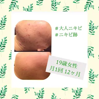 ミディアム カラー パーマ ヘアアレンジ メンズ キッズ ネイル マツエク・マツパ ニキビ・肌質改善専門 ♡人生が変わるサロンのエステ・リラクイメージ