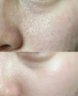 ショート aliaハイフ&水光ジェットサロン所属・aliaハーブ水光店 エステティシャン募集のエステ・リラクイメージ