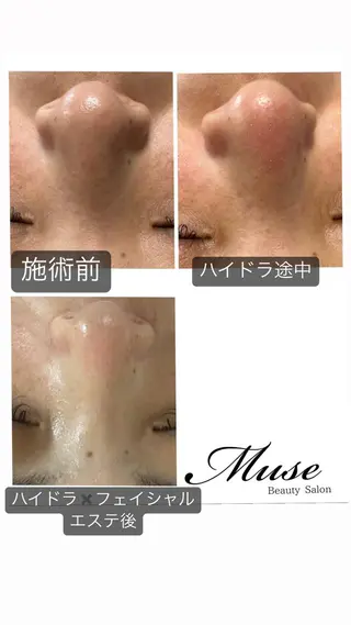 医療提携Beauty SalonMuseのエステ・リラクイメージ