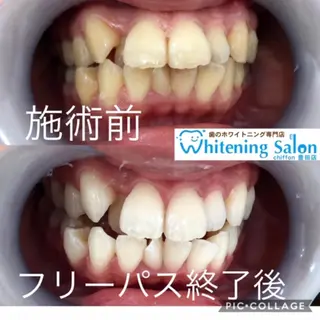歯科レベルの白さ💎 ✨ホワイトニング豊田のエステ・リラクイメージ