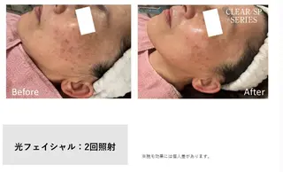 【痩身・脱毛】private salon Eclat所属・伊藤 心のエステ・リラクイメージ