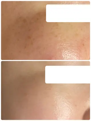 TIERRA(ティエラ)所属・TIERRA ♡のエステ・リラクイメージ