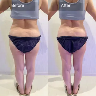 Nature（ナチュレ）所属・【脳洗浄/痩身】 nature東金のエステ・リラクイメージ