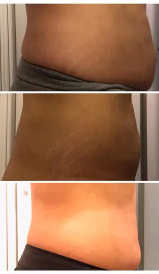 武蔵浦和　小顔矯正 リーフ　　武蔵浦和店のエステ・リラクイメージ