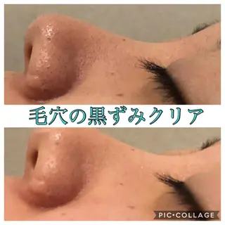 ショート カラー パーマ ヘアアレンジ キッズ ネイル マツエク・マツパ Ensor Clair所属・EnsorClair 代表　野口真央のエステ・リラクイメージ