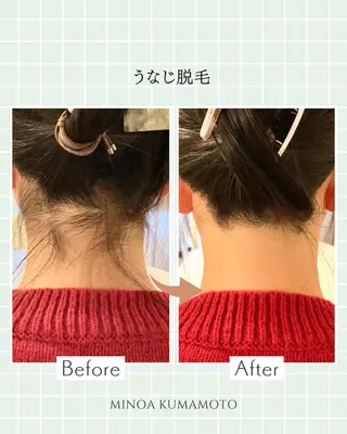 MINOA熊本店所属・MINOA 熊本店のエステ・リラクイメージ