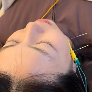 美容鍼　蒼月-aotsuki-所属・美容鍼「蒼月」 -アオツキ-のエステ・リラクイメージ