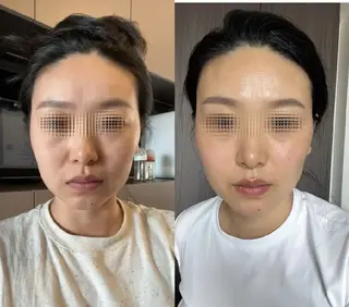 マツエク・マツパ aliaハイフ&水光ジェットサロン所属・aliaハーブ水光店 エステティシャン募集のエステ・リラクイメージ