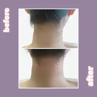 【痩身・脱毛サロン】 REBISKIN🌱のエステ・リラクイメージ