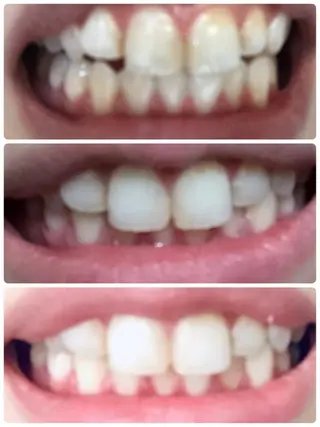 小顔サロン ソ.ルシエのエステ・リラクイメージ